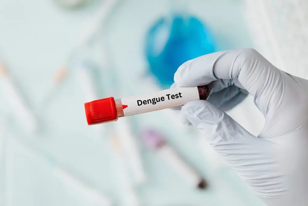 Dengue Fever Blood Test